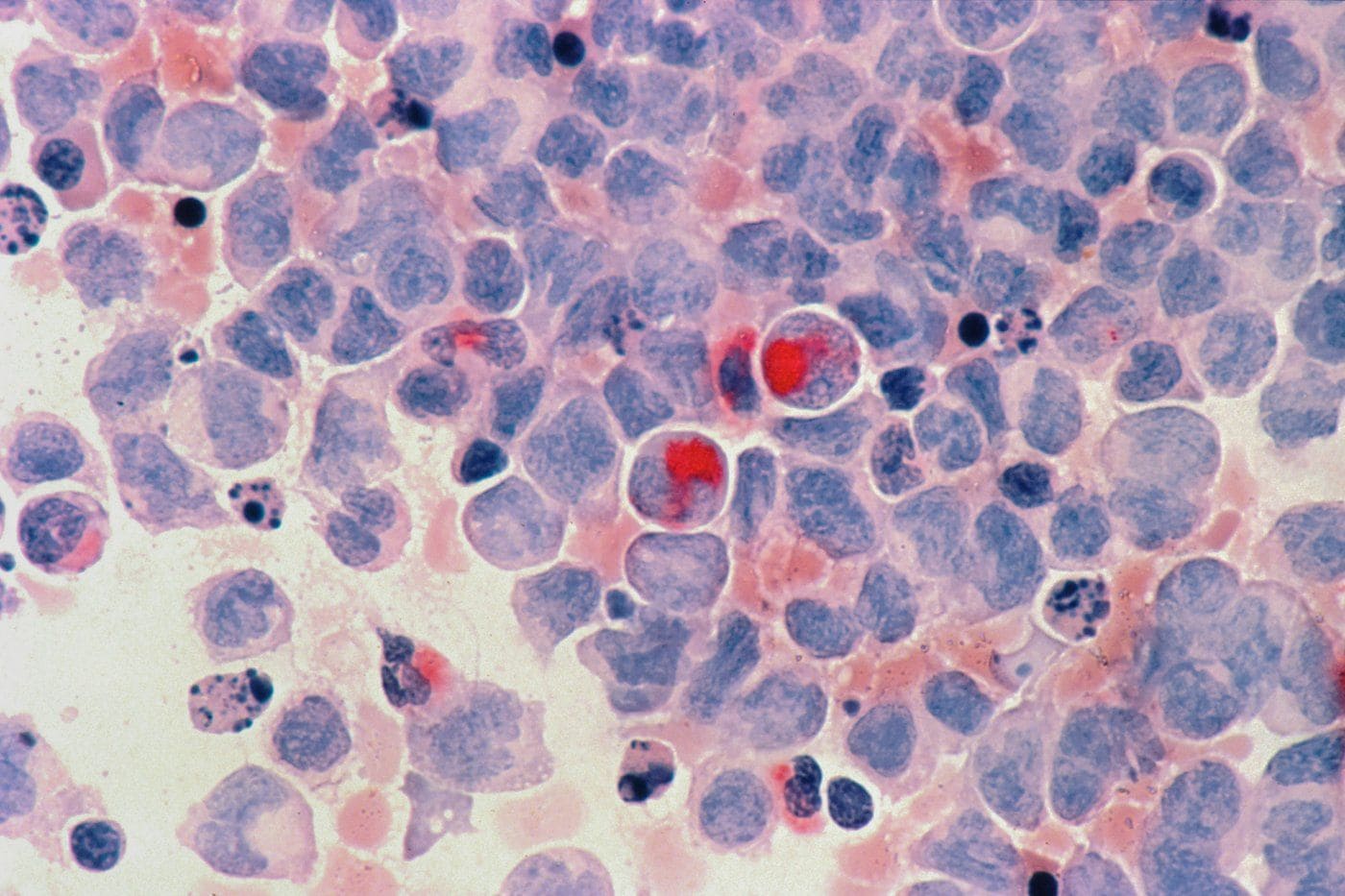 Study shows why younger generations may be more cancer-prone